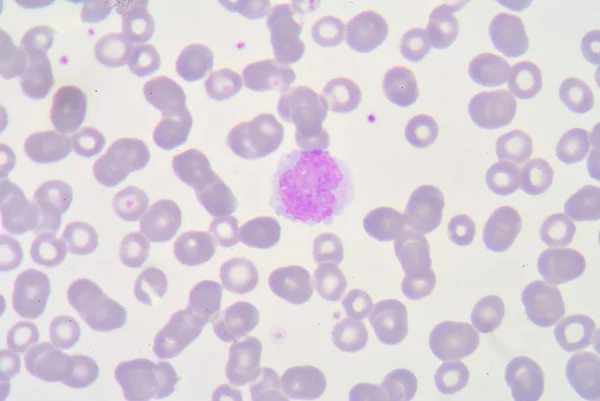 Monocyte — Stock Photo, Image