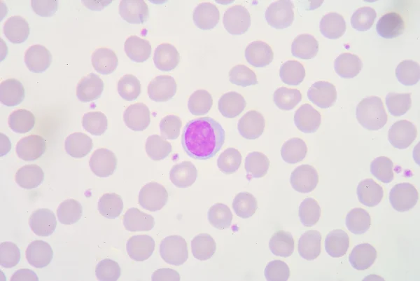 Lymphozyten — Stockfoto