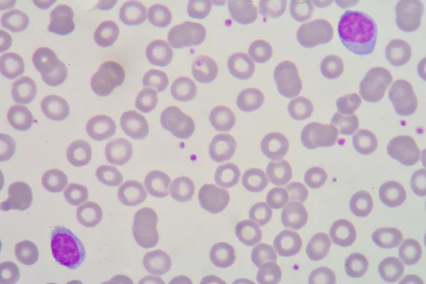 Lymphocyte — Stock Photo, Image