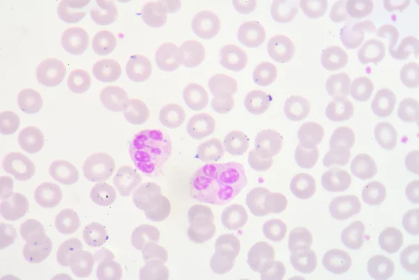Gesegmenteerde neutrofiele granulocyten — Stockfoto
