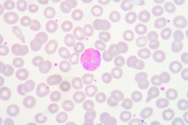 Eosinofilo — Foto Stock