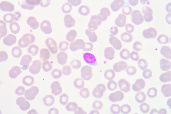 Лимфоциты — стоковое фото