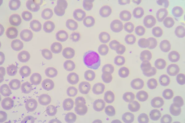 Lymphocyte — Stock Photo, Image