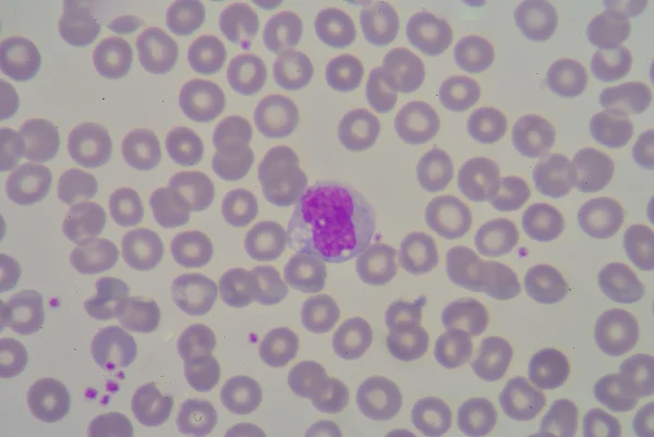 Monocyte — Stock Photo, Image