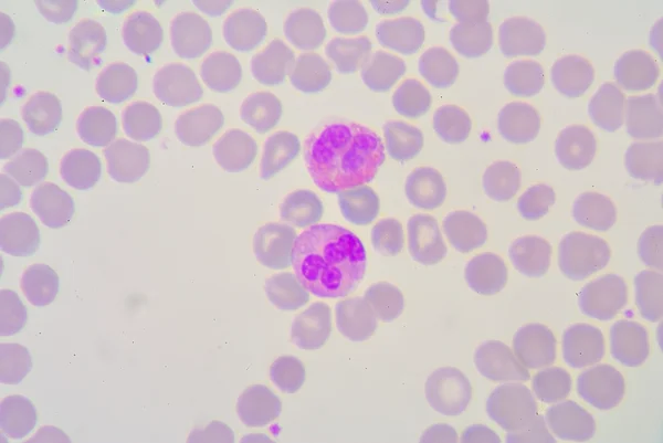 Segmented neutrophils — Stock Photo, Image