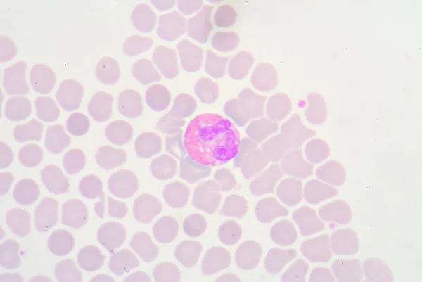 Eosinophil — Stockfoto