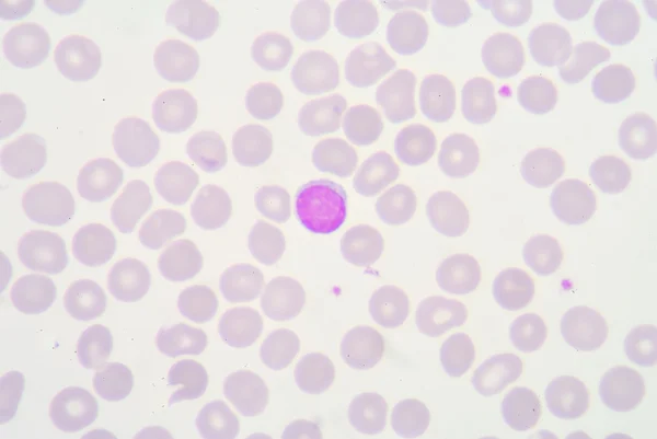 Lymphocytes — Photo