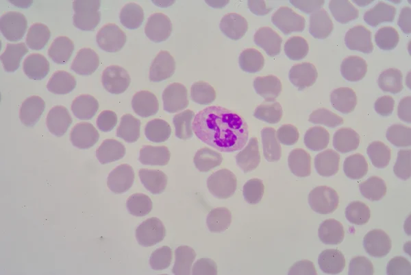 Szegmentált neutrophil — Stock Fotó