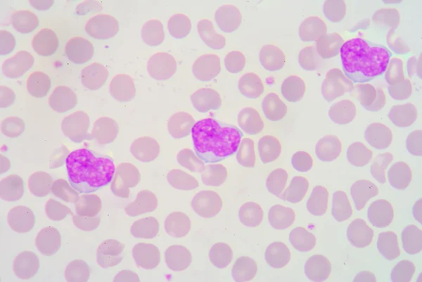 Lymphocyte — Stock Photo, Image