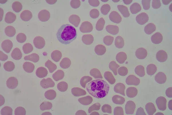 Neutrophil & 림프 구 — 스톡 사진