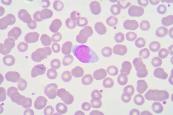 Лимфоциты — стоковое фото