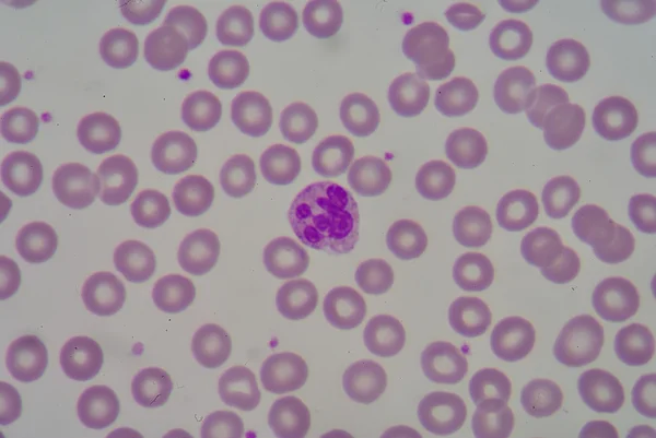 Neutrophil — Stock Fotó