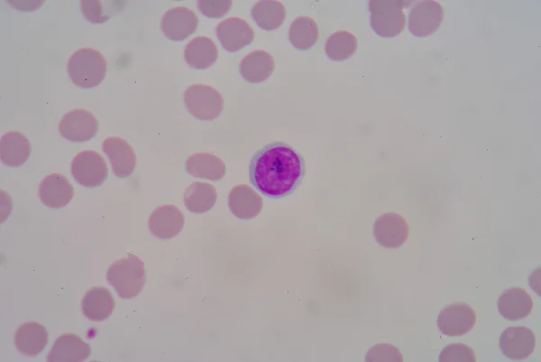 Lymphocyte — Stock Photo, Image