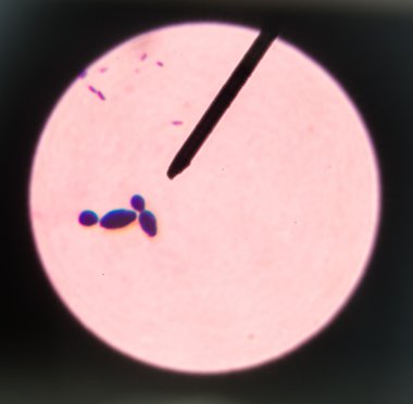 Tomurcuklanma Maya hücreleri.