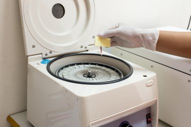 Sağlık Kliniği elektronik Hematokrit santrifüje