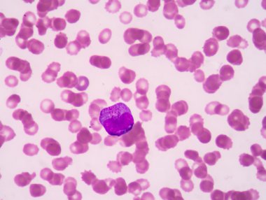 Promyelocyte.