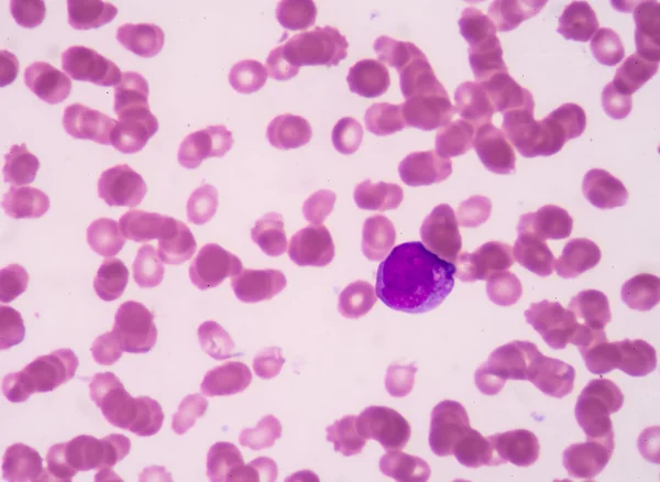 Promyelocyte. — 스톡 사진