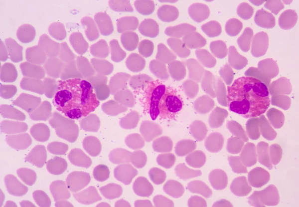 Weiße Blutkörperchen eines Menschen, photomikroskopisch aufgenommen — Stockfoto