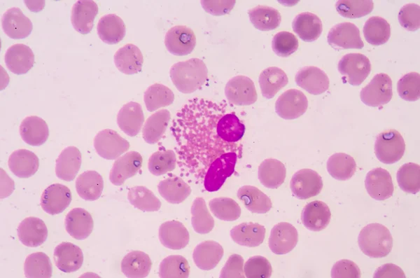 Λευκών αιμοσφαιρίων από ένα ανθρώπινο, Πανόραμα φωτομικρογράφο ως δει u — Φωτογραφία Αρχείου