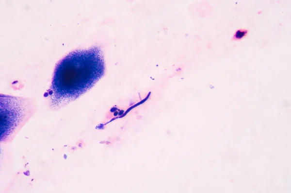 Budding yeast cells with pseudohyphae from sputum gram stain tes — Stock Photo, Image