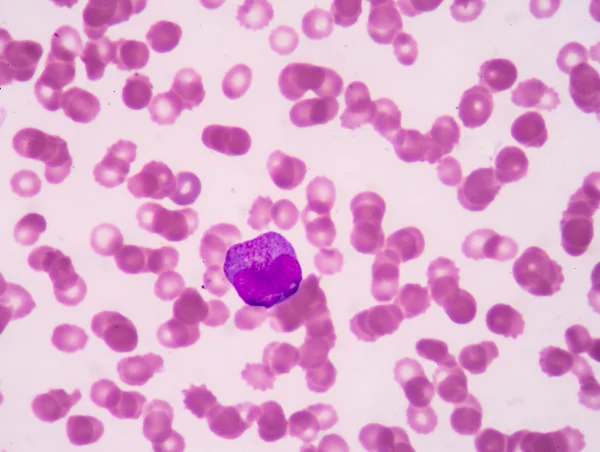 Promyelocyte . — стокове фото