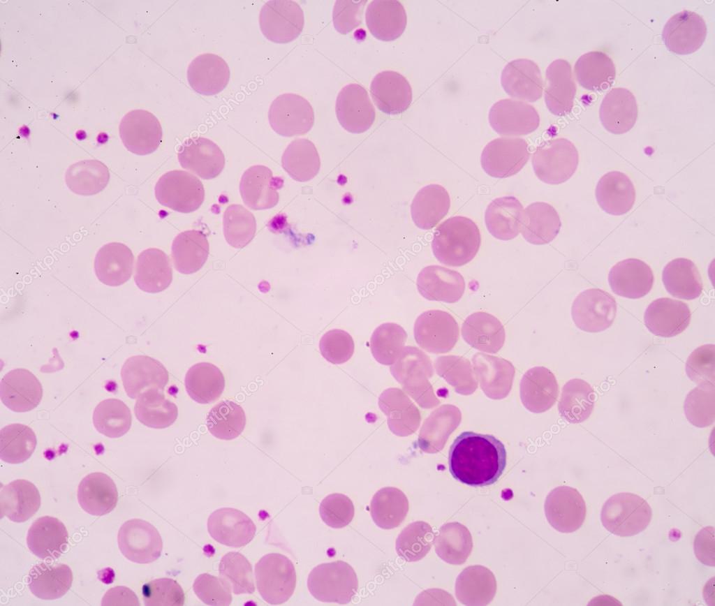 Platelet increase — Stock Photo © toeytoey 78250262