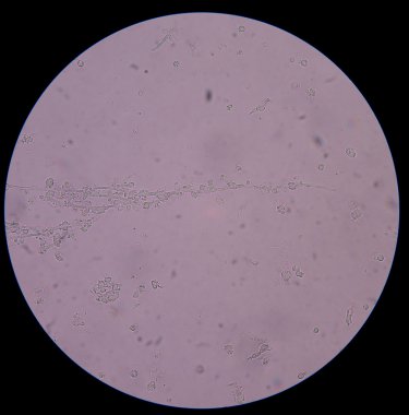 Branching budding yeast cells with pseudohyphae in urine clipart
