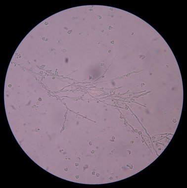 Maya hücreleri idrar pseudohyphae ile filizlenen dallanma