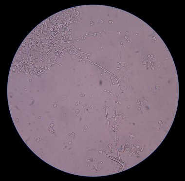 Maya hücreleri idrar pseudohyphae ile filizlenen dallanma