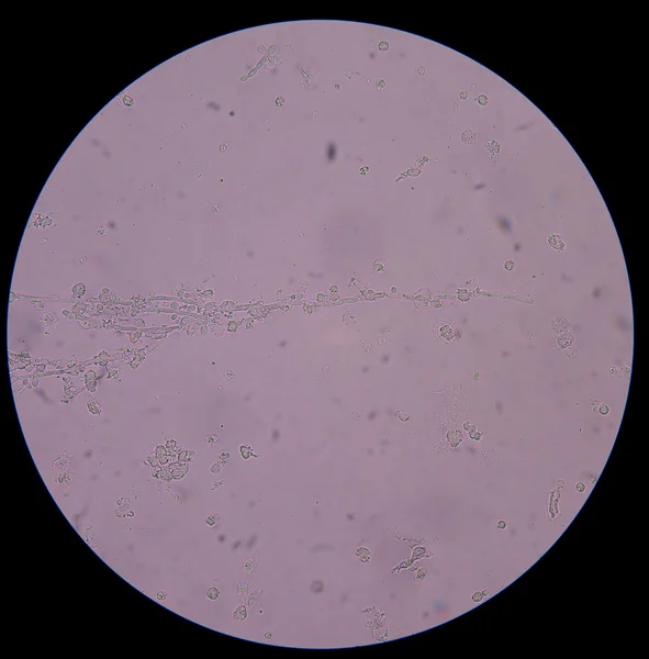 Elágazó kezdő élesztő-sejtek a pseudohyphae a vizeletben — Stock Fotó