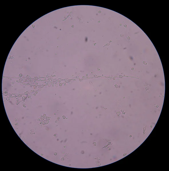 Brandire cellule di lievito in erba con pseudoife nelle urine — Foto Stock