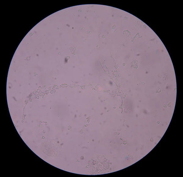 Branching budding yeast cells with pseudohyphae in urine — Stock Photo, Image