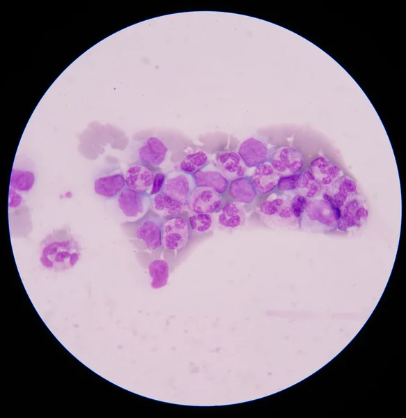 Blood smear is often used as a follow-up test to abnormal result — Stock Photo, Image