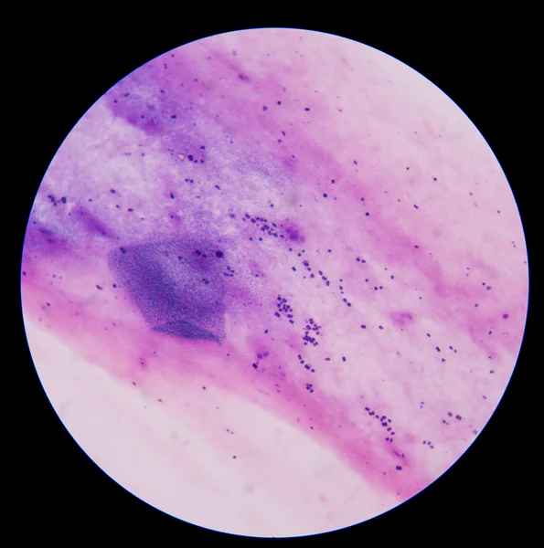 革兰氏阳性球菌 — 图库照片