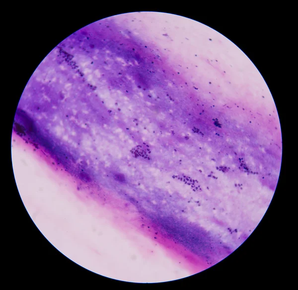 gram pozitif cocci