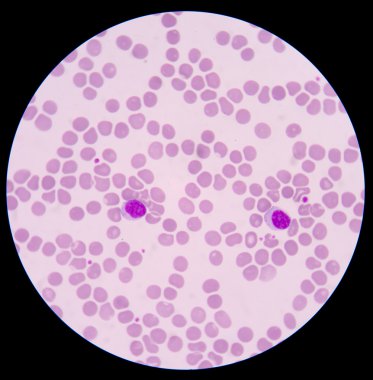 the blood smear. clipart