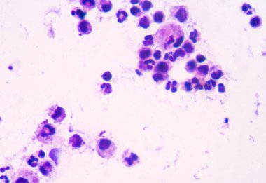 beyaz kan hücrelerinin arka plan