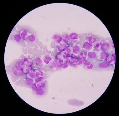 Kan yayması genellikle bir izleme testi anormal sonuç için kullanılır