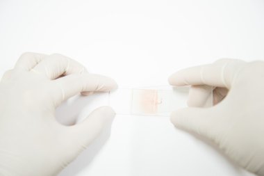 Laboratuvar Doktor kan smear testi veya kan film için hazırlanıyor