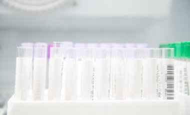 Laboratuvarda test tüpleri