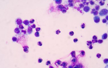 beyaz kan hücreleri.