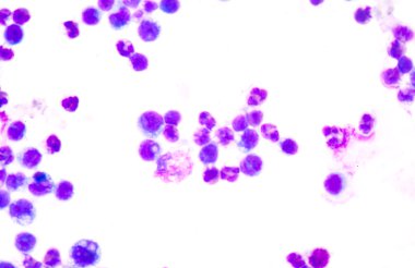 Kan yayması genellikle bir izleme testi anormal sonuç için kullanılır