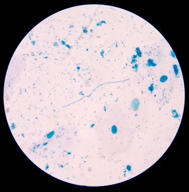 gram pozitif cocci zincirindeki.