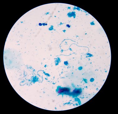 gram pozitif cocci zincirindeki.