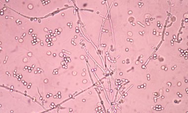 Maya hücreleri pseudohyphae idrar iyi w ile filizlenen dallanma