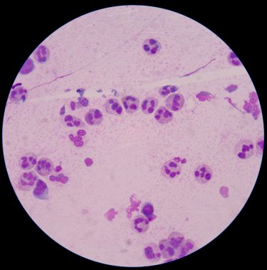 Kimyasal ve hücresel faktörler inflamatuar respo katılan