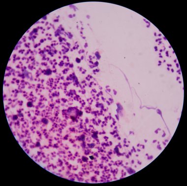 Kimyasal ve hücresel faktörler inflamatuar respo katılan