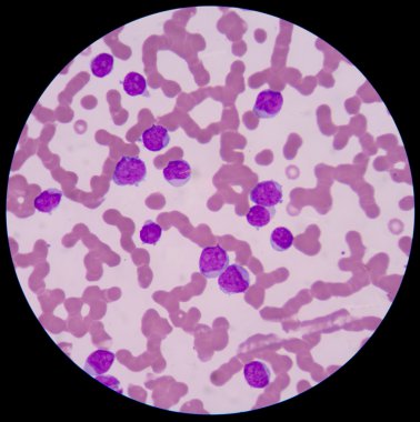  küçük kırmızı pembe normal kırmızı kan hücreleri veya eritrositler.