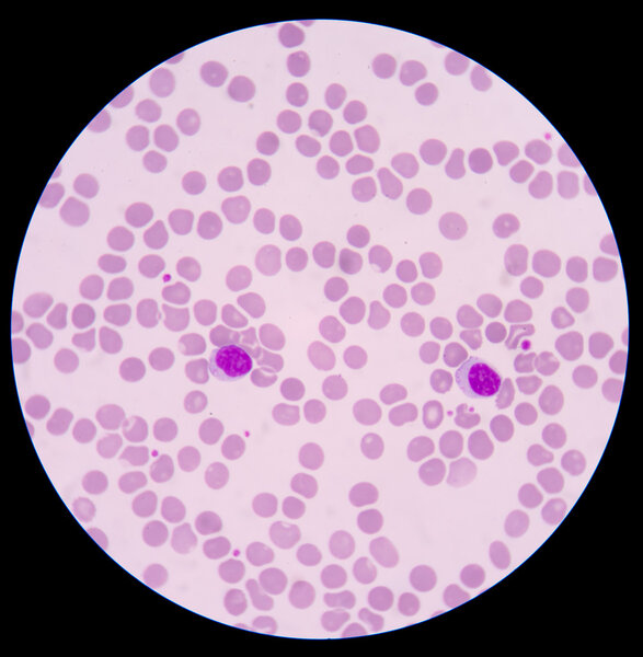 the blood smear.