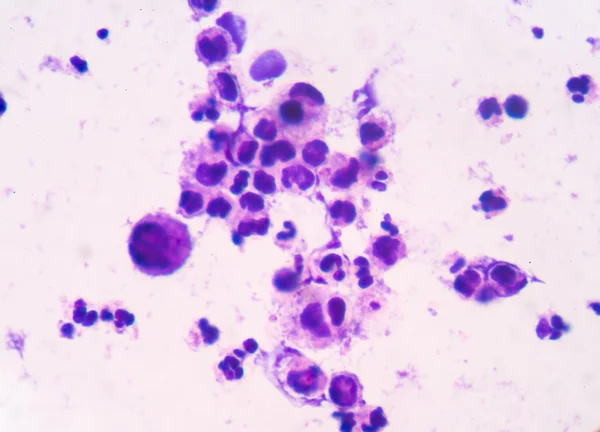White blood cells background — Stock Photo, Image